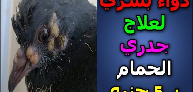علاج جدري الحمام في المنزل دواء بشري لعلاج جدري الحمام